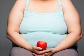 To cure varicose veins, you need to lose extra pounds