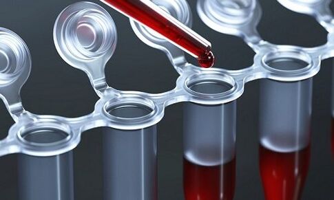 blood test for varicose veins in the legs