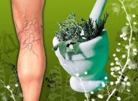 Traditional medicine in the fight against varicose veins of the lower extremities